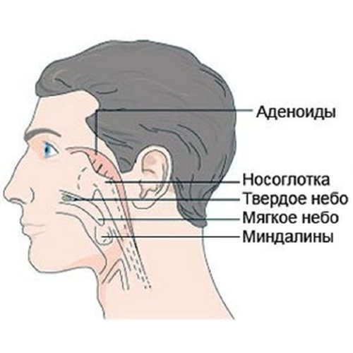 Сольовий розчин і вправи допоможуть позбутися аденоїдів