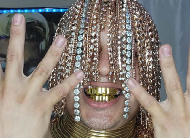 Репер Dan Sur імплантував собі «волосся» з золотих ланцюгів